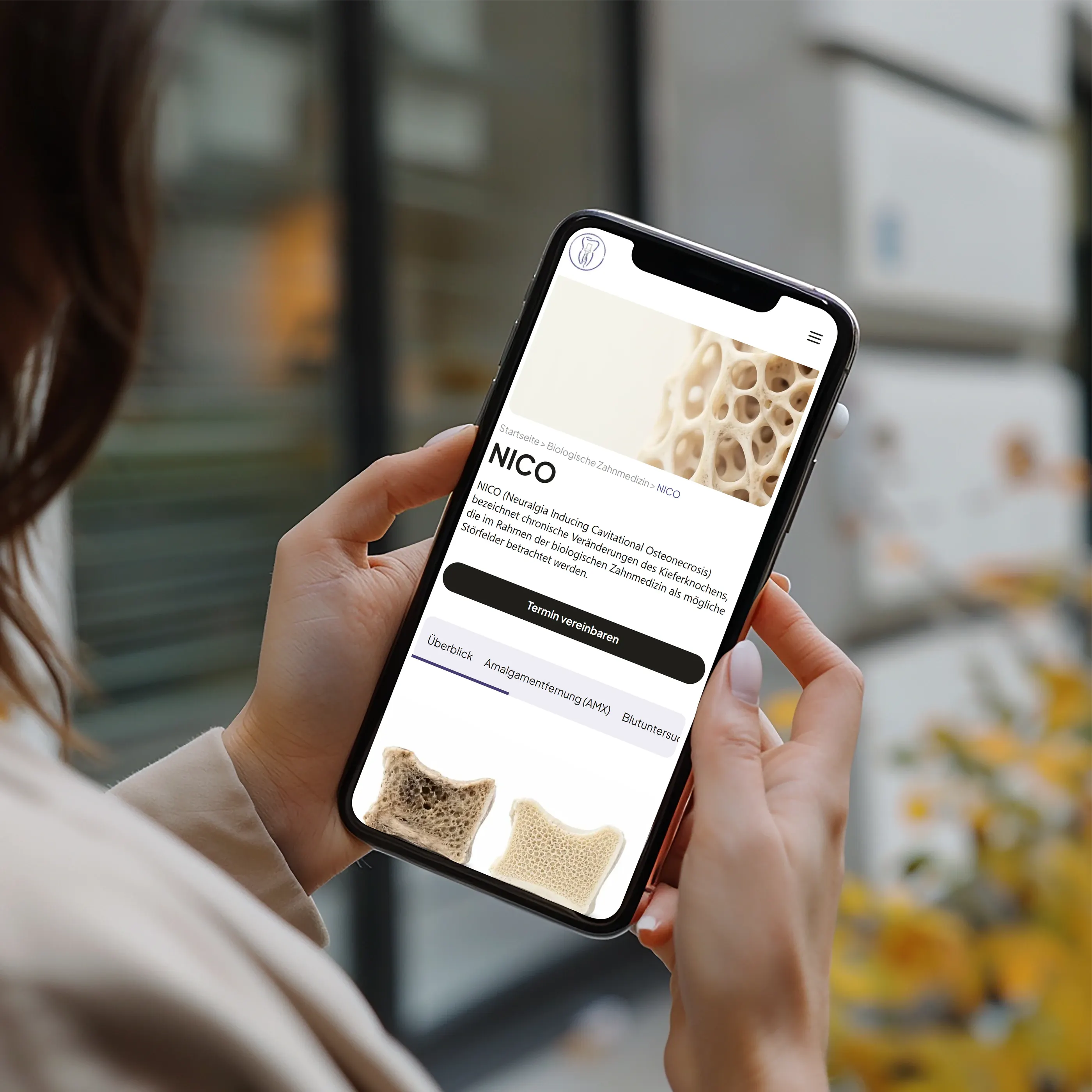 Smartphone mit der Behandlungsseite NICO